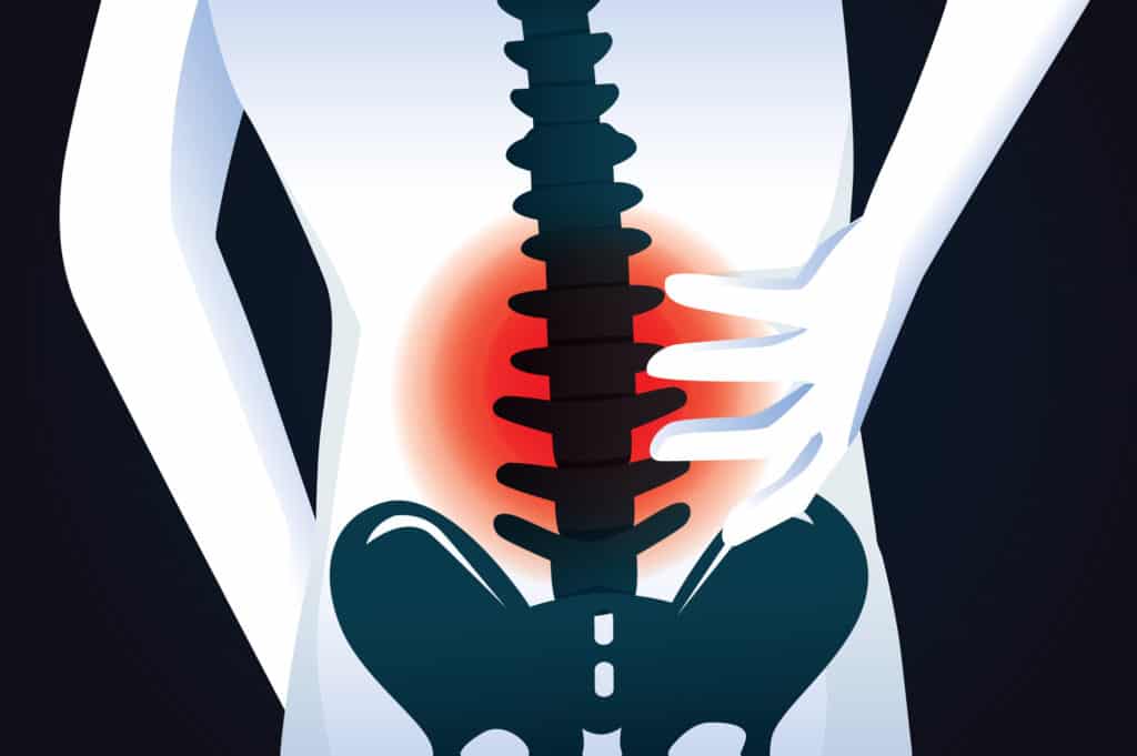 What Is Spinal Stenosis, And How Can I Get Relief?