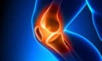 generalised knee pain