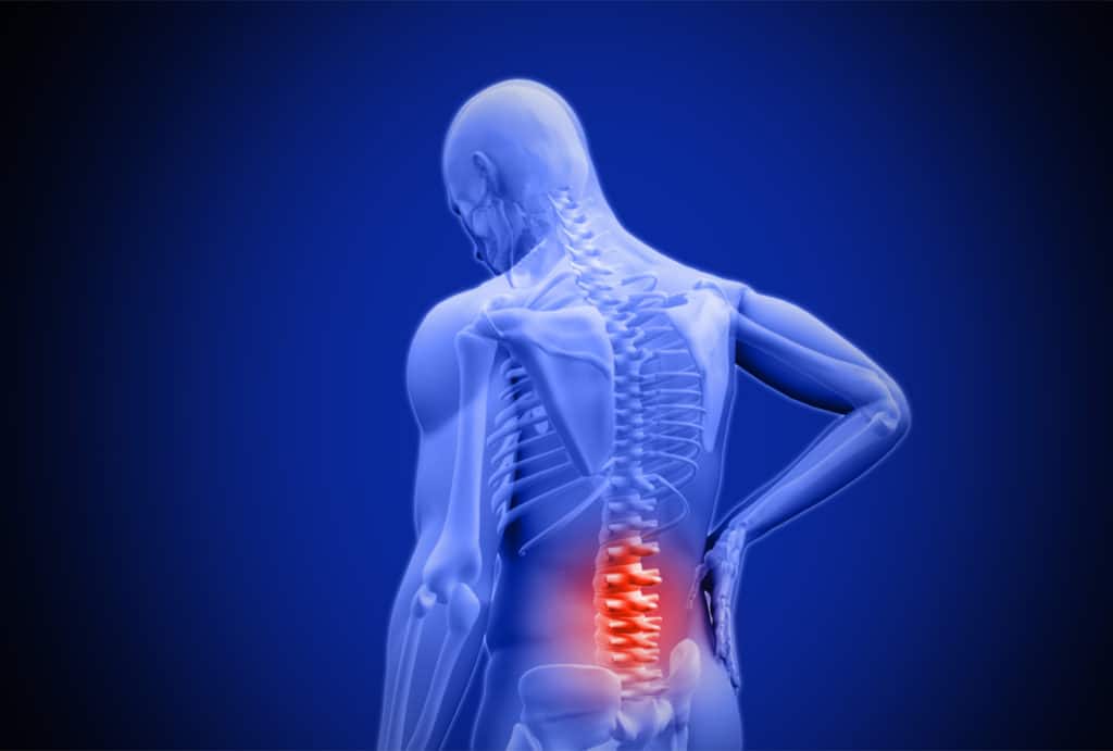 Will lower back pain come back?