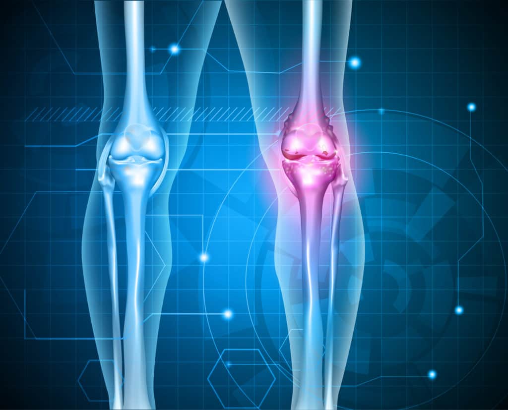 How To Treat Knee Pain 