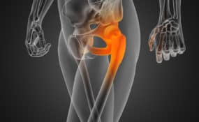 hip joint radiography scan