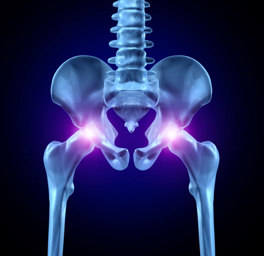 Snapping Hip - Physical Therapy 