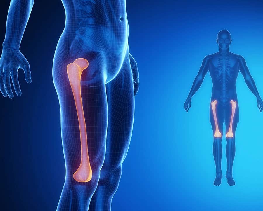 femur bone concept indicating hip and knee pain
